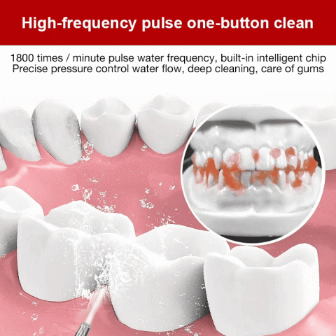 Portable Electric Flosser for Teeth Cleaning